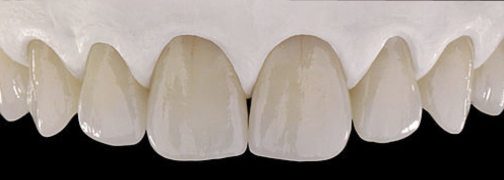 C2 98*22mm Bioceramics Zirconia Oxide Ceramic Super Translucent For Dentistry