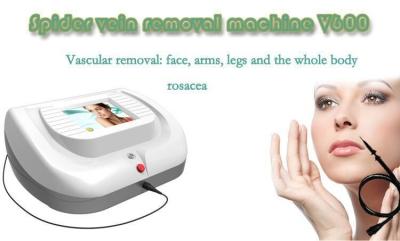 2016 Newest hot-sale high quality 30MHz  hospital blood vessels spider vein removal beauty machine