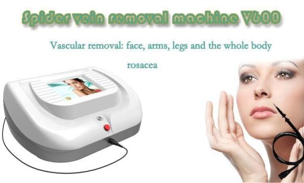 2016 Newest hot-sale high quality 30MHz  hospital blood vessels spider vein removal beauty machine