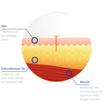 Тело Эмс уменьшая магнитную машину стимулятора мышцы