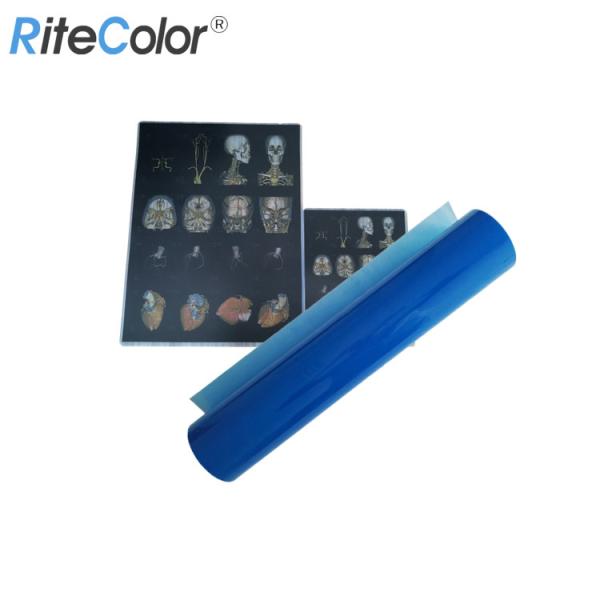 Dry Medical Imaging Blue Base A4 Sheet Inkjet Printing X-Ray Film