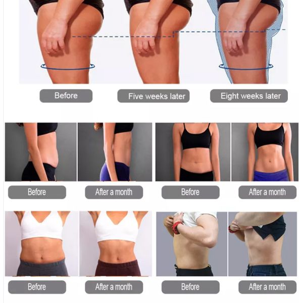 Ce 13 Tesla Ems Slim Machine , Body Sculpting Machine
