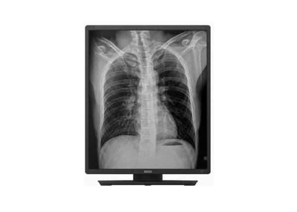 110V Veterinary Digital Radiography Equipment Digital Mobile X Ray Machine