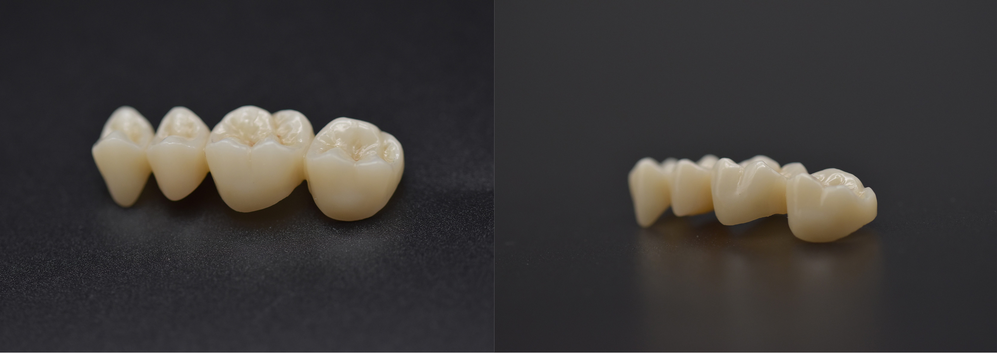 Материал 1100 ложных зубов MPa Pre затенял зубоврачебные блоки Zirconia