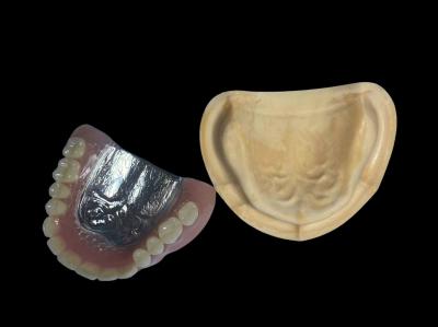 Removable Full Arch Metal Partial Denture Repair Cocr With Yamahachi Acrylic Teeth