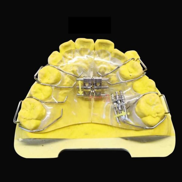 Customized Orthodontic Dental Retainer 3D Laser Printing CE/FDA Certified