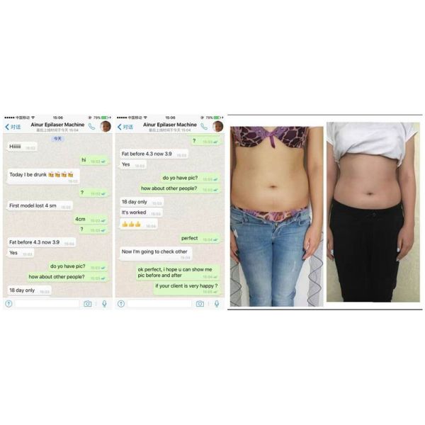 CE FDA approved 80% beauty salon body slimming machine Non-surgical liposonix hifu ultrasound for weoght loss machine