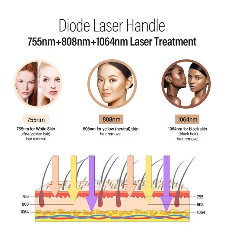 Dual Handles 808nm Diode Laser Hair Removal and Picosecond Laser Tattoo Removal Machine 2in1