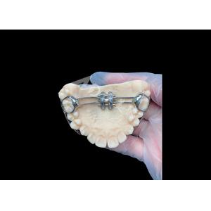MSE Palatal Expander Innovative Orthodontic Appliances For Effective Teeth Alignment