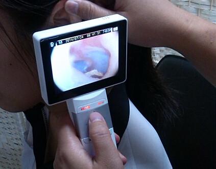O Lcd monitora o Ophthalmoscope video do Otoscope de Digitas para a inspeção clínica do corpo humano