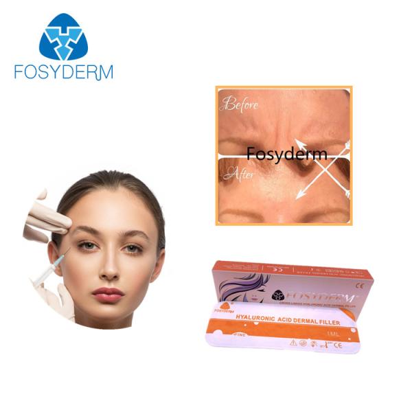 Fosyderm Cross Linked HA 24mg Dermal Filler Hyaluronic Acid Injection