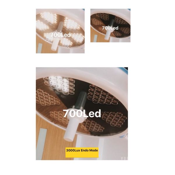 Света операционной СИД 160000 люкс, 450В/² м лампа театра Оператинг