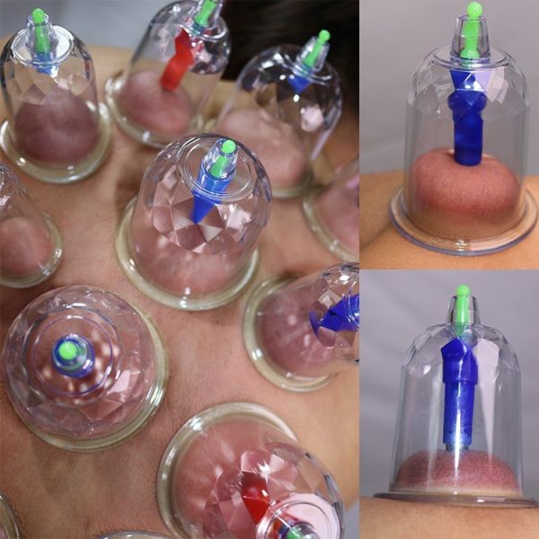 Thick Cupping Wall 32pcs Health Medical Massager Vacuum Suction Hijama Cups Cupping Set