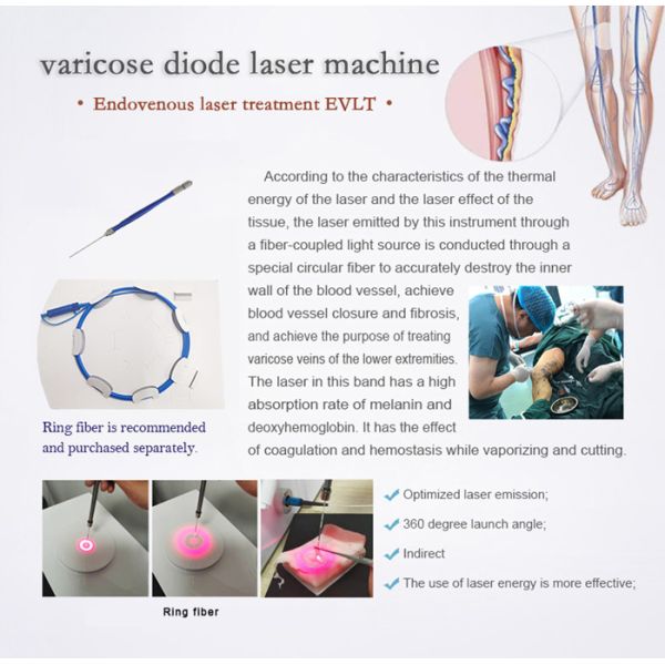 Big power 1470nm diode laser vascular removal  venoclisis laser evlt lipolysis