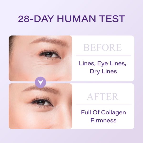 Customizable Anti-Aging Freeze-Dried Serum Polypeptide-Powered New Skin Care Product for Smooth Firm Home Spa Use Face Wrinkles