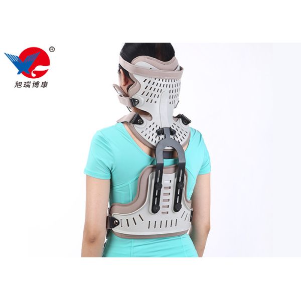 Adjustable Head Neck Chest Medical Orthosis With Aluminum Alloy And Plastic Plate