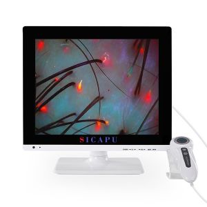 1080P White Hair Scanner Machine LCD Hair And Scalp Analysis Machine