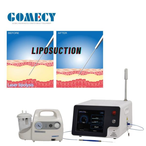 Portable Desktop Endolaser Machine 980nm 1470nm Diode Lasers for Skin Tightening Face Lifting Liposuction Lipolysis