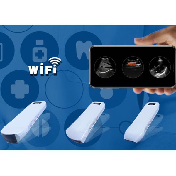 Блок развертки ультразвука кармана Handheld с Wifi подключил с элементами портативной машинки 128 ультразвука Doppler мобильного телефона IPad