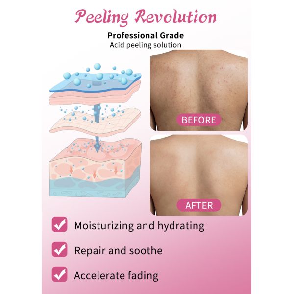 Skin Exfoliating Serum Remove Dead Skin Exfoliation Oil Skin Peeling Solution