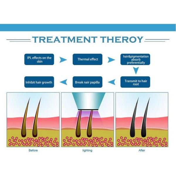Vertical IPL Hair Removal Machine , 360 Magneto - Optic Skin Rejuvenation Device