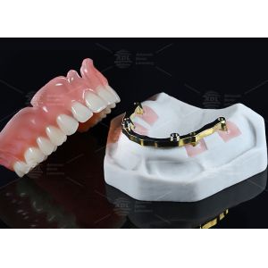 China Dental Lab Titanium Locator Attachment with full acrylic over denture