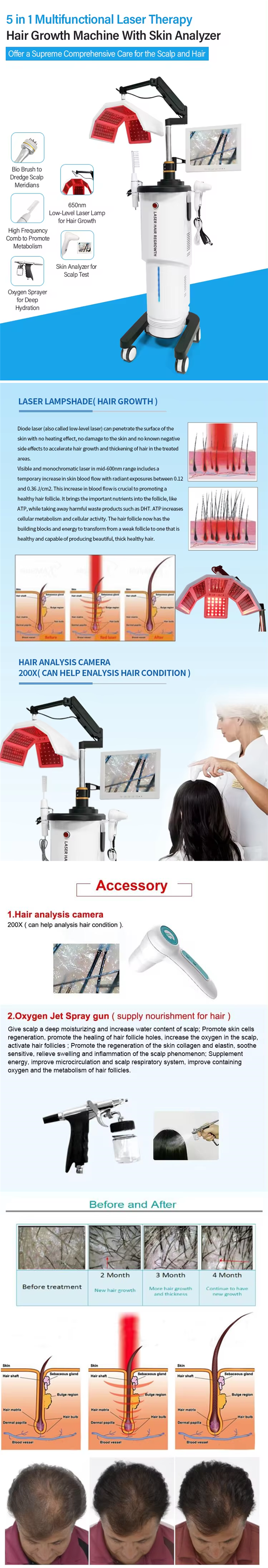 Diode 650nm Light Laser Hair Growth Machine For Hair Loss Treatment