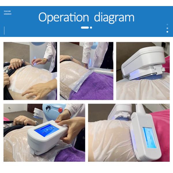 Maquina estetica profesional celulitis 360 productos de belleza equipo estetica para salon de belleza