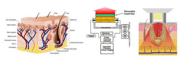 painless SHR OPT hair removal for back, leg