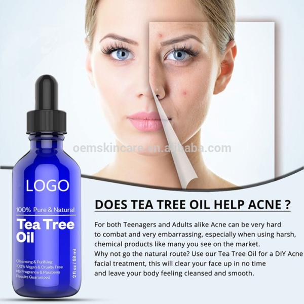 Обработка угорь естественным благоуханием эфирных масел дерева чая чистым противобактериологическим свободная