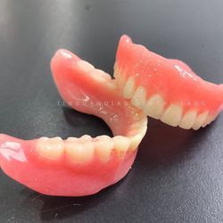 Medical Grade Acrylic Material Removable Full Dentures Dental Lab