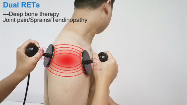 Tecar Therapy Physiotherapy Indiba 300KHz Tecar Terapy Fascia Tecar Machine Physiotherapy Veterinary Therapy Machine