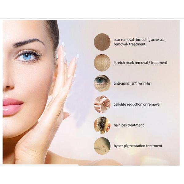 Медицинская переключенная q машина лазера Nd Yag, машина удаления татуировки лазера красоты