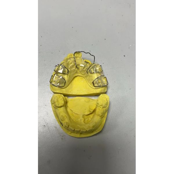 Custom Fit Orthodontic Facemask with Palatal Springs and Adjustable Design