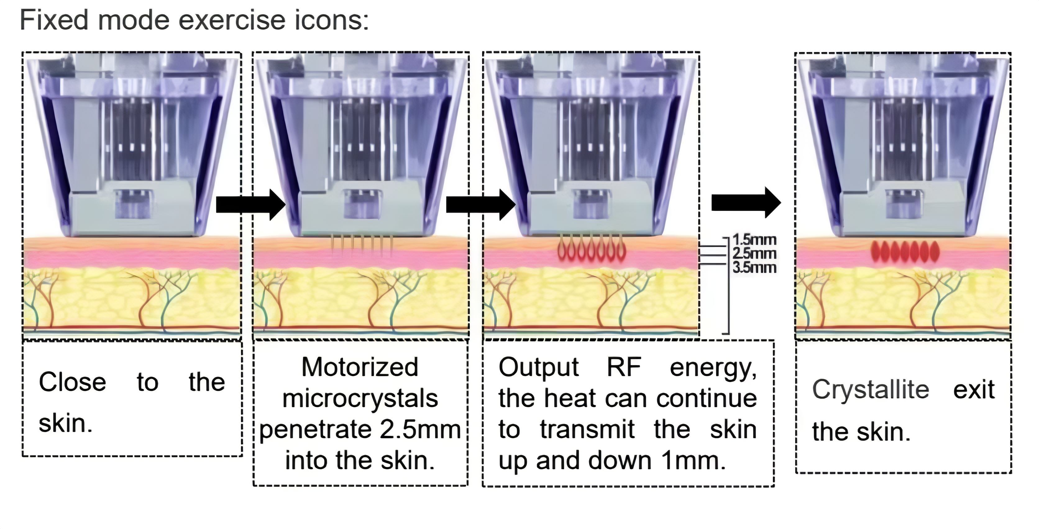 RF Microneedling Machine for Skin Tightening, Acne Scars & Pores