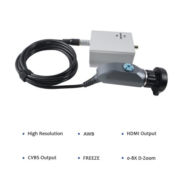 TUYOU Fabrique directe Prix Endoscope médical portable appareil photo pour ENT gynécologie urologie