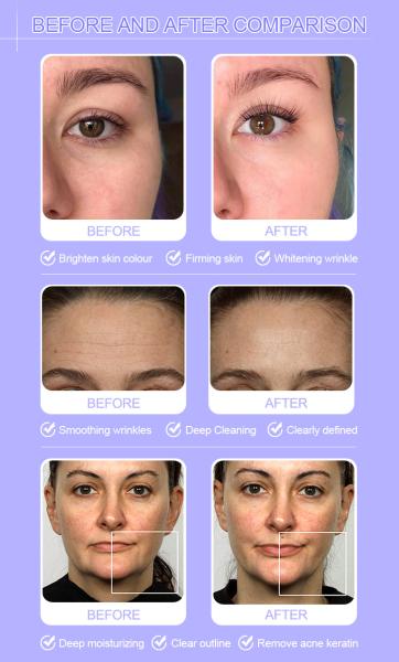 OEM 11 em 1 Hydra Dermabrasion Machine Equipamento hidrofásico para salão de beleza