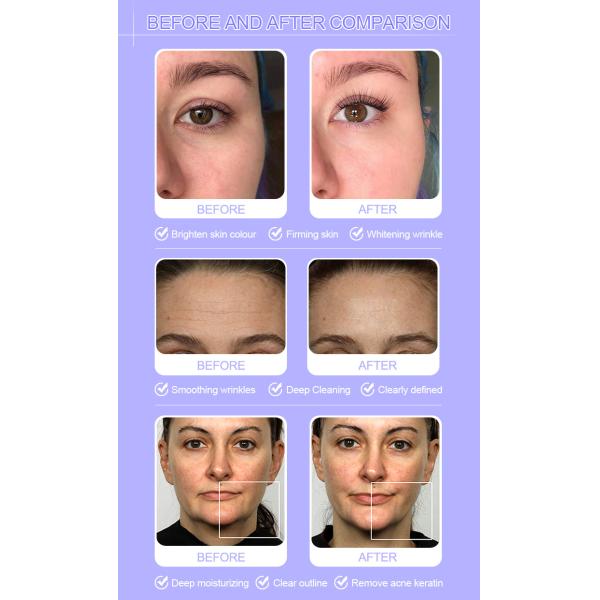 OEM 11 In 1 Hydra Dermabrasion Machine Hydrofacial Equipment For Beauty Salon