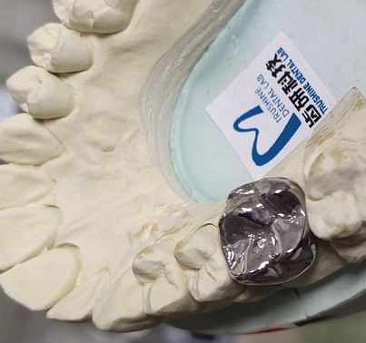 Metal Blank Milling PFM Inner Crown Dental 3D Print