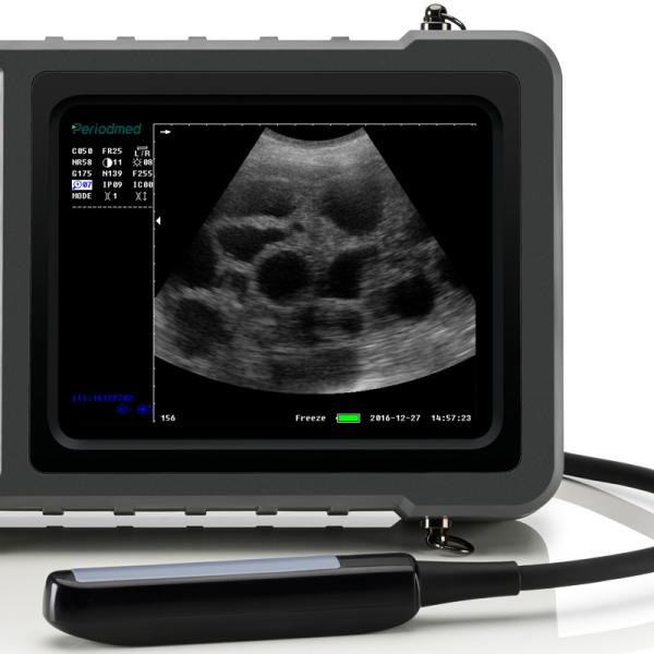 Yonker Veterinary Ultrasound Pregnancy Ultrasound Scanner for Animal Dog Vet Portable Digital Ultrasound