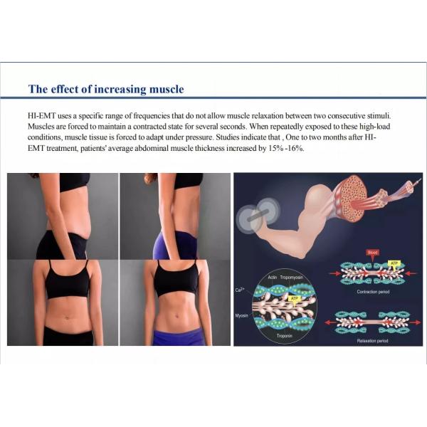 Тело IPL скульптуры мышцы контуря уменьшающ машину