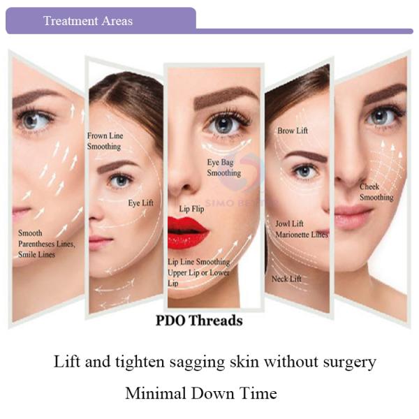 Beauty Thread Face Lift 3D COG Barbed Sharp Needle Disposable Cannula