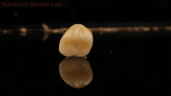 Mill and Centring Full Zirconia Crown , China Dental Lab Fast Delivery