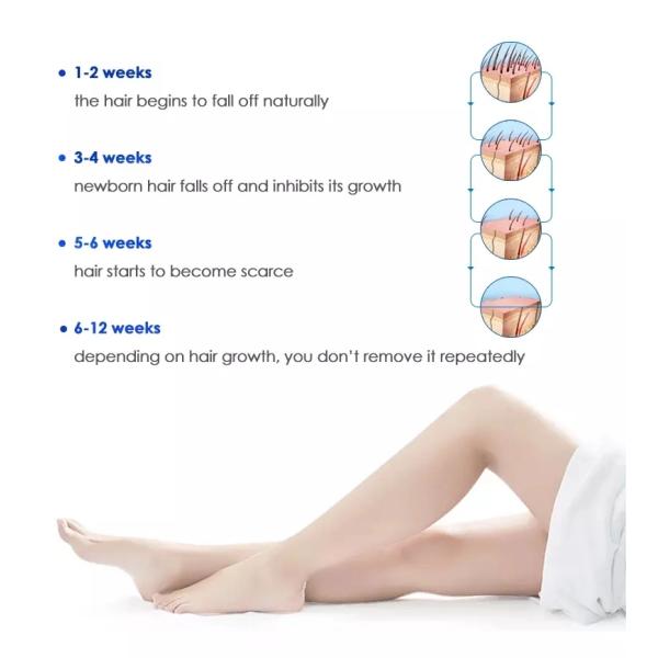 Оборудование красоты ИПЛ машины удаления волос всего тела лазера с обработкой пигментацией