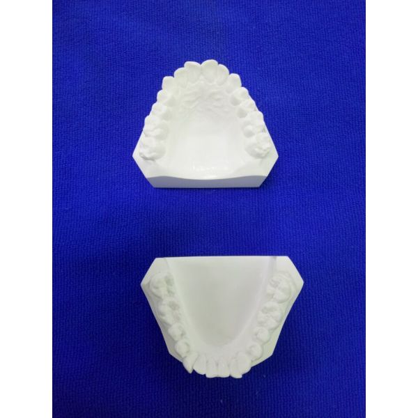 Dental Study Model with CAD CAM Digital Design and 3D Printing Workflow for Precision Dental Solutions