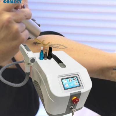 1064nm 532nm 1320nm Q Switch Nd YAG Máquina de remoção de tatuagens a laser com peeling de carbono