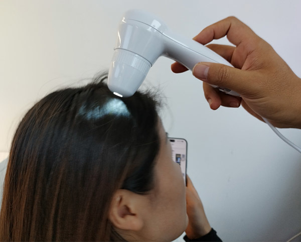 Multifunctional Portable Anti Hair Loss Therapy Machine Featuring 7 Inches Hair Testing Function For Personal And Commercial Salon Hair Health Examination