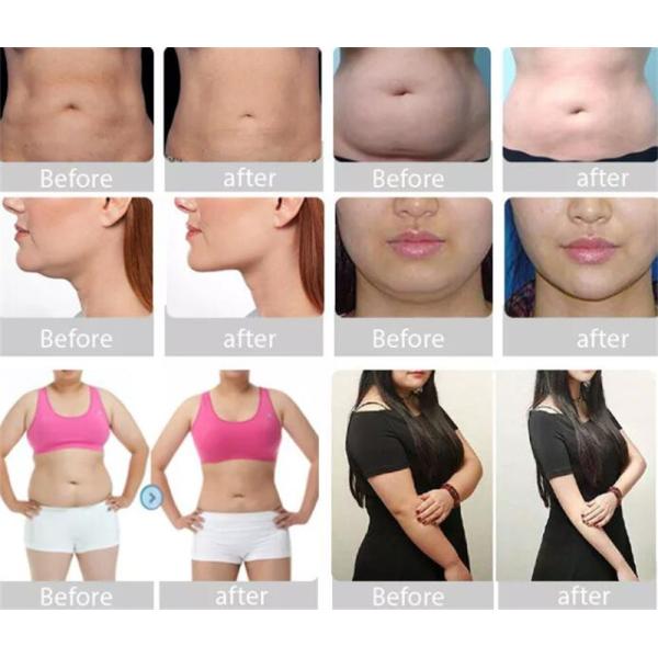 Портативное тело 650nm Cryolipolysis уменьшая машину жирную замерзающ 6 In1