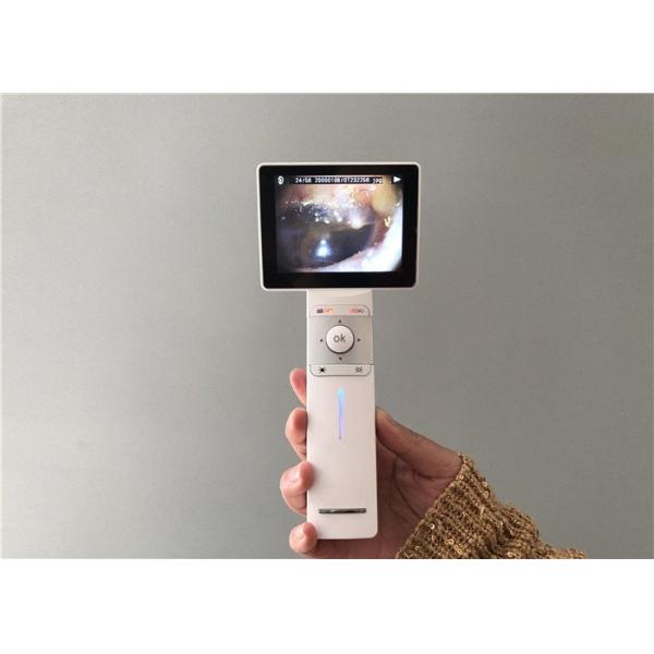 Воображение и Дерматоскопе микро- Отоскопе цифров камеры уха УСБ карты СД видео- общее