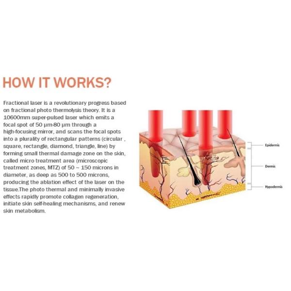 Оборудование красоты обработки шрама лазера СО2 ИМПа ульс повторения частичное